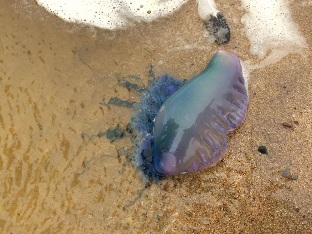 Treating jellyfish stings - what to do if you get stung by a jellyfish when swimming in the sea